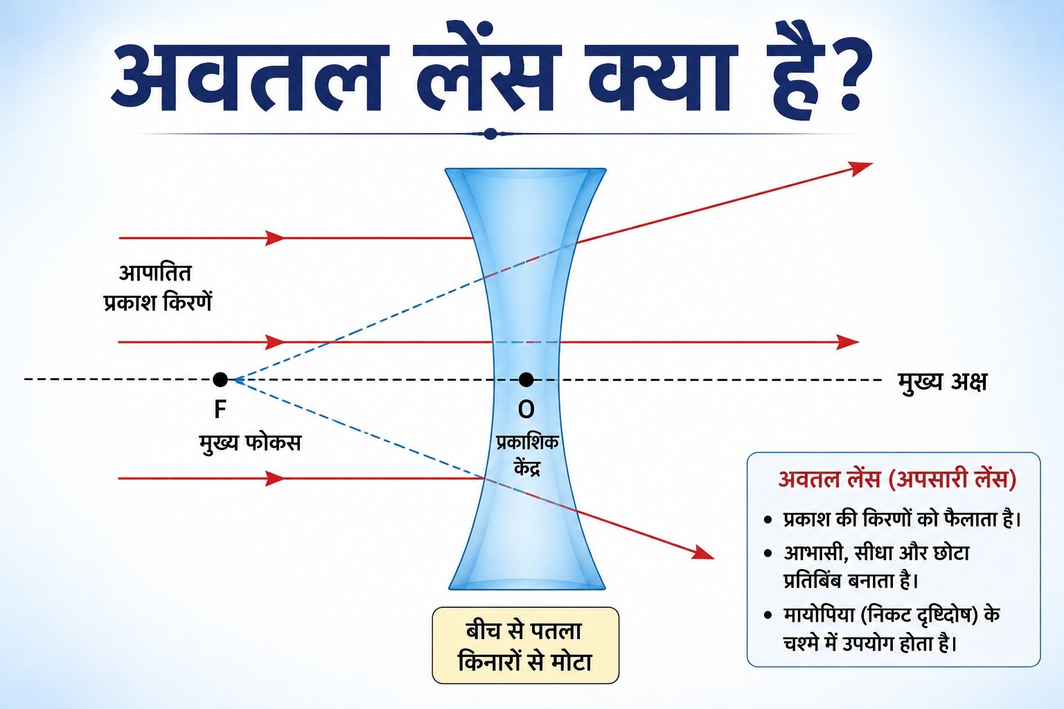 Avtal Lens Kya Hai